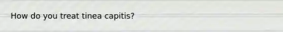 How do you treat tinea capitis?