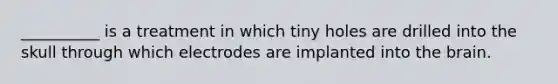 __________ is a treatment in which tiny holes are drilled into the skull through which electrodes are implanted into the brain.