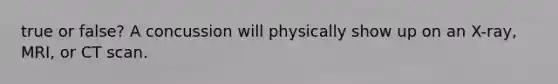 true or false? A concussion will physically show up on an X-ray, MRI, or CT scan.