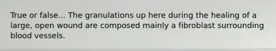 True or false... The granulations up here during the healing of a large, open wound are composed mainly a fibroblast surrounding blood vessels.