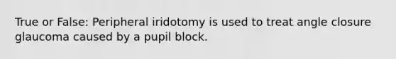 True or False: Peripheral iridotomy is used to treat angle closure glaucoma caused by a pupil block.