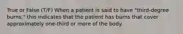 True or False (T/F) When a patient is said to have "third-degree burns," this indicates that the patient has burns that cover approximately one-third or more of the body.