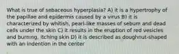 What is true of sebaceous hyperplasia? A) it is a hypertrophy of the papillae and epidermis caused by a virus B) it is characterized by whitish, pearl-like masses of sebum and dead cells under the skin C) it results in the eruption of red vesicles and burning, itching skin D) it is described as doughnut-shaped with an indention in the center