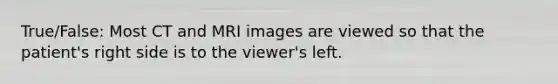 True/False: Most CT and MRI images are viewed so that the patient's right side is to the viewer's left.