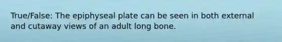 True/False: The epiphyseal plate can be seen in both external and cutaway views of an adult long bone.