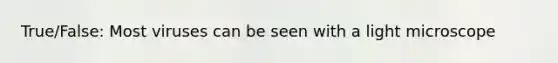 True/False: Most viruses can be seen with a light microscope