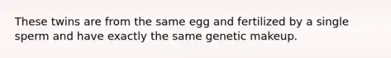 These twins are from the same egg and fertilized by a single sperm and have exactly the same genetic makeup.