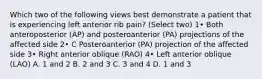 Which two of the following views best demonstrate a patient that is experiencing left anterior rib pain? (Select two) 1• Both anteroposterior (AP) and posteroanterior (PA) projections of the affected side 2• C Posteroanterior (PA) projection of the affected side 3• Right anterior oblique (RAO) 4• Left anterior oblique (LAO) A. 1 and 2 B. 2 and 3 C. 3 and 4 D. 1 and 3