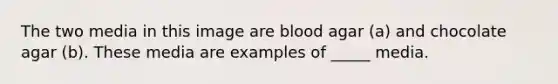 The two media in this image are blood agar (a) and chocolate agar (b). These media are examples of _____ media.