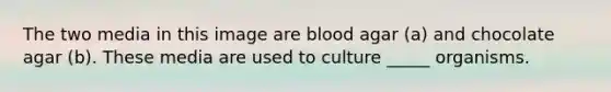 The two media in this image are blood agar (a) and chocolate agar (b). These media are used to culture _____ organisms.