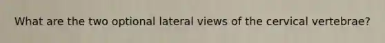 What are the two optional lateral views of the cervical vertebrae?