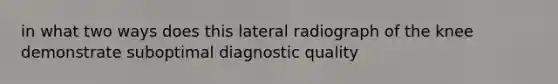 in what two ways does this lateral radiograph of the knee demonstrate suboptimal diagnostic quality