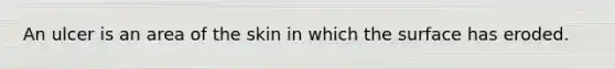 An ulcer is an area of the skin in which the surface has eroded.