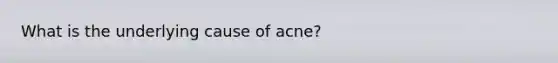 What is the underlying cause of acne?