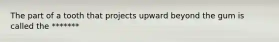 The part of a tooth that projects upward beyond the gum is called the *******