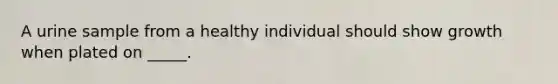 A urine sample from a healthy individual should show growth when plated on _____.