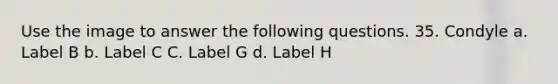 Use the image to answer the following questions. 35. Condyle a. Label B b. Label C C. Label G d. Label H