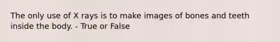 The only use of X rays is to make images of bones and teeth inside the body. - True or False