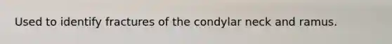 Used to identify fractures of the condylar neck and ramus.