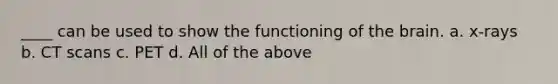 ____ can be used to show the functioning of the brain. a. x-rays b. CT scans c. PET d. All of the above