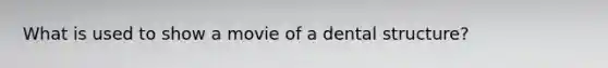 What is used to show a movie of a dental structure?