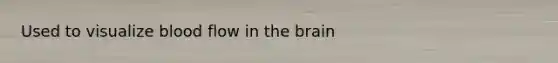 Used to visualize blood flow in the brain