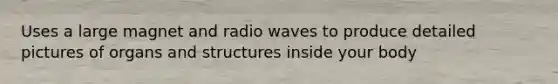 Uses a large magnet and radio waves to produce detailed pictures of organs and structures inside your body