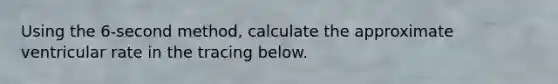 Using the 6-second method, calculate the approximate ventricular rate in the tracing below.