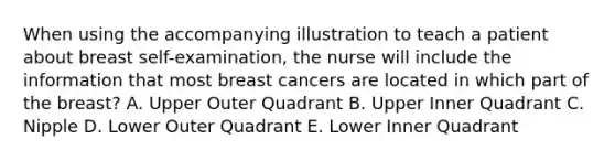 When using the accompanying illustration to teach a patient about breast self-examination, the nurse will include the information that most breast cancers are located in which part of the breast? A. Upper Outer Quadrant B. Upper Inner Quadrant C. Nipple D. Lower Outer Quadrant E. Lower Inner Quadrant