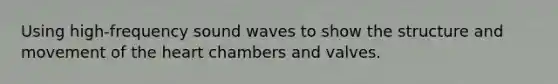 Using high-frequency sound waves to show the structure and movement of the heart chambers and valves.