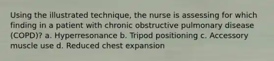 Using the illustrated technique, the nurse is assessing for which finding in a patient with chronic obstructive pulmonary disease (COPD)? a. Hyperresonance b. Tripod positioning c. Accessory muscle use d. Reduced chest expansion