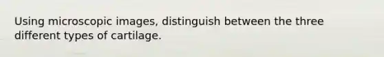 Using microscopic images, distinguish between the three different types of cartilage.