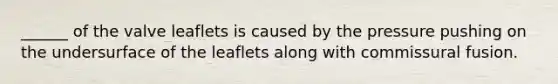 ______ of the valve leaflets is caused by the pressure pushing on the undersurface of the leaflets along with commissural fusion.