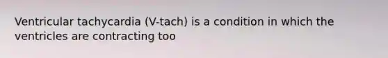 Ventricular tachycardia (V-tach) is a condition in which the ventricles are contracting too