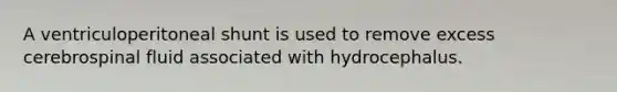 A ventriculoperitoneal shunt is used to remove excess cerebrospinal fluid associated with hydrocephalus.