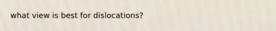 what view is best for dislocations?