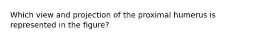 Which view and projection of the proximal humerus is represented in the figure?