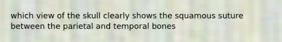 which view of the skull clearly shows the squamous suture between the parietal and temporal bones