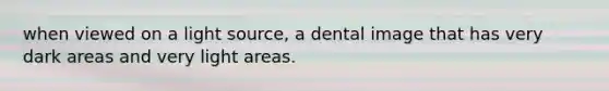 when viewed on a light source, a dental image that has very dark areas and very light areas.