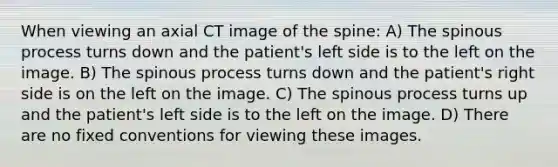 When viewing an axial CT image of the spine: A) The spinous process turns down and the patient's left side is to the left on the image. B) The spinous process turns down and the patient's right side is on the left on the image. C) The spinous process turns up and the patient's left side is to the left on the image. D) There are no fixed conventions for viewing these images.