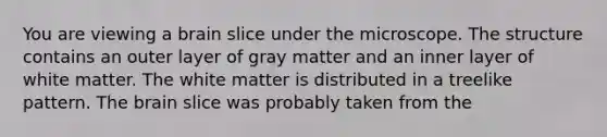 You are viewing a brain slice under the microscope. The structure contains an outer layer of gray matter and an inner layer of white matter. The white matter is distributed in a treelike pattern. The brain slice was probably taken from the