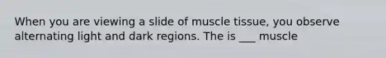 When you are viewing a slide of muscle tissue, you observe alternating light and dark regions. The is ___ muscle