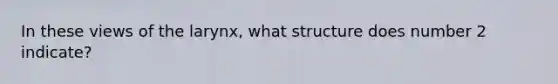 In these views of the larynx, what structure does number 2 indicate?