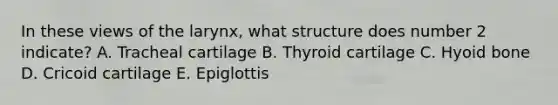 In these views of the larynx, what structure does number 2 indicate? A. Tracheal cartilage B. Thyroid cartilage C. Hyoid bone D. Cricoid cartilage E. Epiglottis