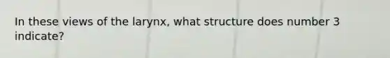 In these views of the larynx, what structure does number 3 indicate?