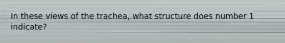 In these views of the trachea, what structure does number 1 indicate?
