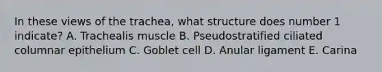 In these views of the trachea, what structure does number 1 indicate? A. Trachealis muscle B. Pseudostratified ciliated columnar epithelium C. Goblet cell D. Anular ligament E. Carina