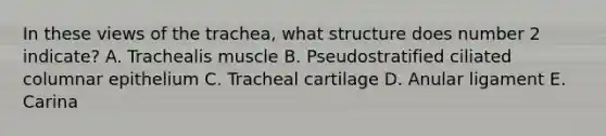 In these views of the trachea, what structure does number 2 indicate? A. Trachealis muscle B. Pseudostratified ciliated columnar epithelium C. Tracheal cartilage D. Anular ligament E. Carina