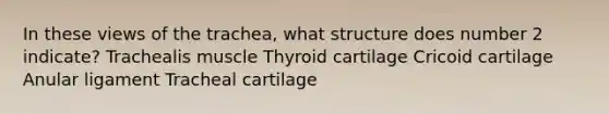 In these views of the trachea, what structure does number 2 indicate? Trachealis muscle Thyroid cartilage Cricoid cartilage Anular ligament Tracheal cartilage