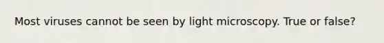 Most viruses cannot be seen by light microscopy. True or false?